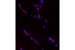 Immunofluorescent analysis of paraformaldehyde-fixed rat skeletal muscle using HECTD1 (ABIN7074186) at dilution of,1: 2000 (HECTD1 antibody)