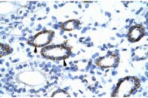 Immunohistochemical staining (Formalin-fixed paraffin-embedded sections) of human kidney with GTF2F2 polyclonal antibody  at 4-8 ug/mL working concentration. (GTF2F2 antibody  (C-Term))