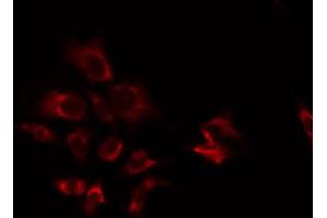 ABIN6274879 staining HT29 by IF/ICC. (ATP5S antibody  (Internal Region))