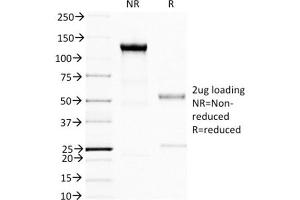 SDS-PAGE Analysis Purified BRCA1 Mouse Monoclonal Antibody (BRCA1/1398). (BRCA1 antibody  (AA 445-620))