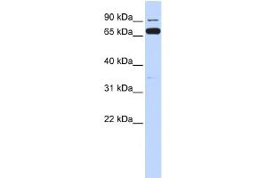 WB Suggested Anti-IKBKB Antibody Titration:  0. (IKBKB antibody  (Middle Region))
