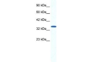 WB Suggested Anti-AIP Antibody Titration:  1.