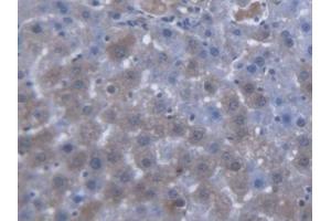 DAB staining on IHC-P; Samples: Rat Liver Tissue (SLC25A20 antibody  (AA 1-211))