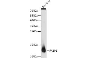 Western blot analysis of extracts of rat liver, using F antibody (ABIN6131636, ABIN6140414, ABIN6140415 and ABIN6220935) at 1:1000 dilution. (FABP1 antibody  (AA 1-127))