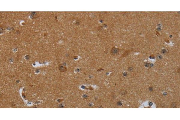 ENTPD7 antibody