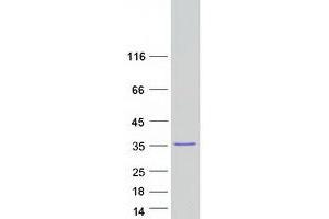 PX Domain Containing 1 (PXDC1) protein (Myc-DYKDDDDK Tag)