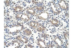 Immunohistochemistry (IHC) image for anti-Arginase, Liver (ARG1) (N-Term) antibody (ABIN2773866) (Liver Arginase antibody  (N-Term))