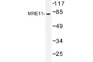 Image no. 1 for anti-MRE11 Meiotic Recombination 11 Homolog A (S. Cerevisiae) (MRE11A) antibody (ABIN272302) (Mre11 antibody)