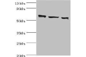Western blot All lanes: COIL antibody at 3 μg/mL Lane 1: MCF-7 whole cell lysate Lane 2: Hela whole cell lysate Lane 3: HepG2 whole cell lysate Secondary Goat polyclonal to rabbit IgG at 1/10000 dilution Predicted band size: 63 kDa Observed band size: 63 kDa (Coilin antibody  (AA 297-576))
