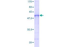 RSU1 Protein (AA 1-277) (GST tag)