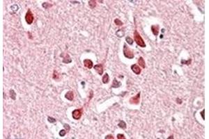 Image no. 1 for anti-Unc-5 Homolog C (C. Elegans) (Unc5c) (Internal Region) antibody (ABIN452309) (Unc5c antibody  (Internal Region))