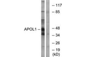 Western blot analysis of extracts from A549 cells, using APOL1 Antibody. (APOL1 antibody  (AA 261-310))