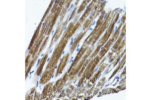 Immunohistochemistry of paraffin-embedded rat heart using ICMT Rabbit pAb (ABIN6128077, ABIN6142129, ABIN6142130 and ABIN6214491) at dilution of 1:200 (40x lens). (ICMT antibody  (AA 175-284))