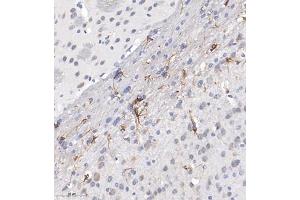 Immunohistochemistry of paraffin embedded mouse brain using ACyclaseI (ABIN7072958) at dilution of 1:650 (300x lens) (ADCY1 antibody)