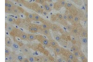 DAB staining on IHC-P; Samples: Human Liver Tissue (SHB antibody  (AA 252-507))