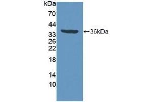 Detection of Recombinant VCP, Human using Polyclonal Antibody to Valosin Containing Protein (VCP) (VCP antibody  (AA 125-371))