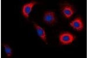 Immunofluorescent analysis of EGFR (pY1016) staining in Jurkat cells. (EGFR antibody  (C-Term, pTyr1016))