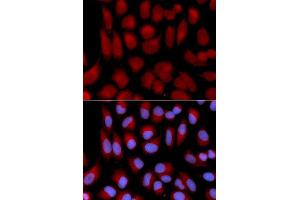 Immunofluorescence analysis of U2OS cell using TAP2 antibody.