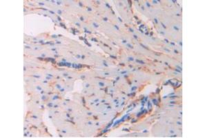 IHC-P analysis of Mouse Heart Tissue, with DAB staining. (CD34 antibody  (AA 36-287))