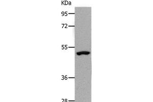 Western Blot analysis of Human lymphoma tissue using NDRG1 Polyclonal Antibody at dilution of 1:1000 (NDRG1 antibody)