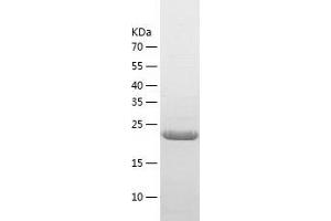 LAT2 Protein (AA 27-243) (His tag)