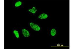 Immunofluorescence (IF) image for anti-Caudal Type Homeobox 1 (CDX1) (AA 126-215) antibody (ABIN560319)
