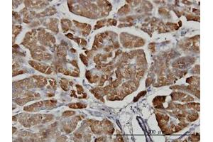 Image no. 1 for anti-Carboxypeptidase B1 (Tissue) (CPB1) (AA 14-418) antibody (ABIN598622) (CPB1 antibody  (AA 14-418))