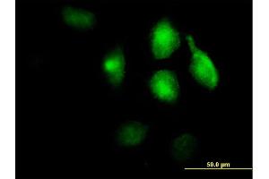 Immunofluorescence of purified MaxPab antibody to LRP1 on HeLa cell. (LRP1 antibody  (AA 1-292))