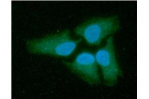 ICC/IF analysis of LDHB in HeLa cells line, stained with DAPI (Blue) for nucleus staining and monoclonal anti-human LDHB antibody (1:100) with goat anti-mouse IgG-Alexa fluor 488 conjugate (Green). (LDHB antibody)