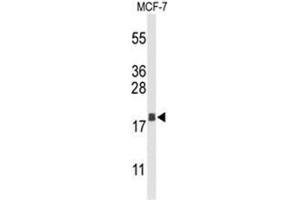 Western blot analysis of AGR3 Antibody (C-term) in MCF-7 cell line lysates (35µg/lane). (AGR3 antibody  (C-Term))