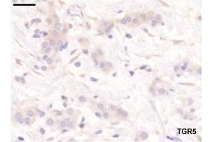 Staining pattern of the antibodies used in the study. (GPBAR1 antibody  (C-Term))