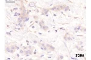 Staining pattern of the antibodies used in the study.