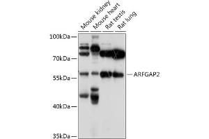 Western blot analysis of extracts of various cell lines, using  antibody (ABIN7265486) at 1:1000 dilution. (arfgap2 antibody  (AA 242-521))