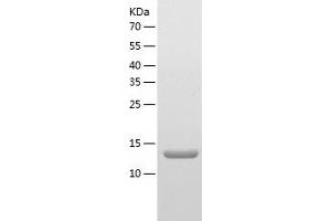 Western Blotting (WB) image for tRNA Methyltransferase 11-2 (TRMT112) (AA 1-125) protein (His tag) (ABIN7289284) (TRMT112 Protein (AA 1-125) (His tag))