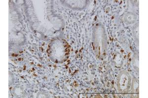 Immunoperoxidase of monoclonal antibody to IKBKG on formalin-fixed paraffin-embedded human stomach.