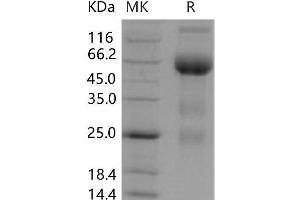 Western Blotting (WB) image for Fms-Related Tyrosine Kinase 4 (FLT4) (Active) protein (Fc Tag) (ABIN7195829) (FLT4 Protein (Fc Tag))