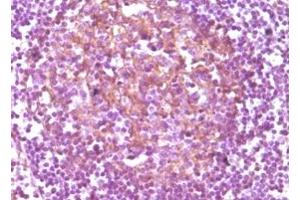 Immunohistochemistry (IHC) image for anti-CD14 (CD14) antibody (ABIN2464028) (CD14 antibody)