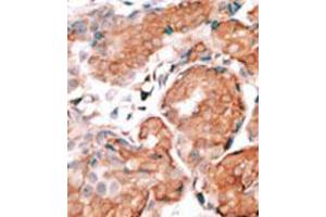 Image no. 1 for anti-Guanylate Cyclase Activator 1A (Retina) (GUCA1A) (C-Term) antibody (ABIN357117) (GCAP1 antibody  (C-Term))