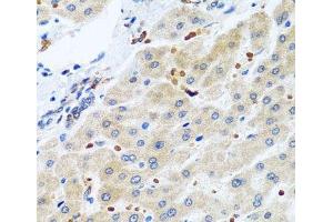 Immunohistochemistry of paraffin-embedded Human liver using RGS5 Polyclonal Antibody at dilution of 1:100 (40x lens). (RGS5 antibody)