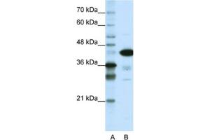 Western Blotting (WB) image for anti-TAR DNA Binding Protein (TARDBP) antibody (ABIN2461819) (TARDBP antibody)