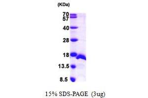 SDS-PAGE (SDS) image for Pre-mRNA Branch Site Protein p14 (SF3B14) (AA 1-125) protein (His tag) (ABIN667356) (Pre-mRNA Branch Site Protein p14 (SF3B14) (AA 1-125) protein (His tag))