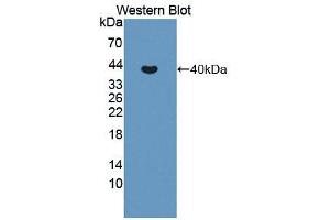 Western blot analysis of the recombinant protein. (MMP10 antibody  (AA 154-472))