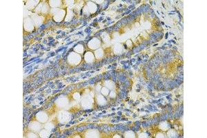 Immunohistochemistry of paraffin-embedded Rat intestine using PGK1 Polyclonal Antibody at dilution of 1:100 (40x lens). (PGK1 antibody)
