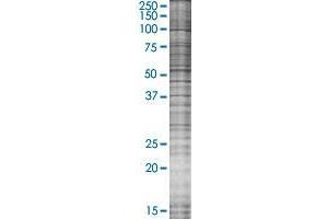 ORC6L transfected lysate. (ORC6L 293T Cell Transient Overexpression Lysate(Denatured))