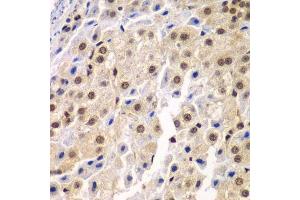Immunohistochemistry (Paraffin-embedded Sections) (IHC (p)) image for anti-Splicing Factor 3b, Subunit 2, 145kDa (SF3B2) (AA 616-895) antibody (ABIN6147666)