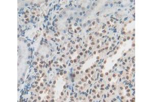 Used in DAB staining on fromalin fixed paraffin- embedded Kidney tissue (YAF2 antibody  (AA 1-180))