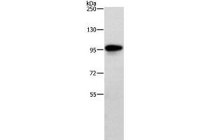 Western Blot analysis of Human brain malignant glioma tissue using TRAF3IP1 Polyclonal Antibody at dilution of 1:500 (TRAF3IP1 antibody)