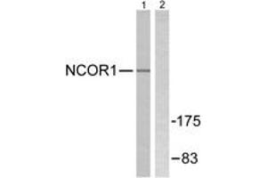 Western blot analysis of extracts from MDA-MB-435 cells, using NCoR1 Antibody. (NCOR1 antibody  (AA 51-100))