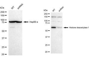 Western blotting analysis using Histone deacetylase 1 antibody (ABIN7798925). (Recombinant HDAC1 antibody)