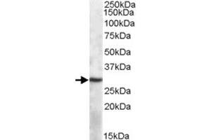 APOBEC1 polyclonal antibody  (1 ug/mL) staining of mouse spleen lysate (35 ug protein in RIPA buffer).